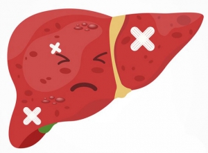 Bỏ túi ngay những điều cần biết về bệnh Viêm Gan